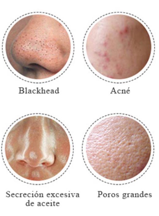 Espátula Ultrasonido Facial (Piel de porcelana)