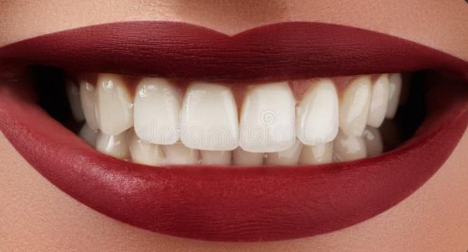 Smilekit menta blanqueadora dental